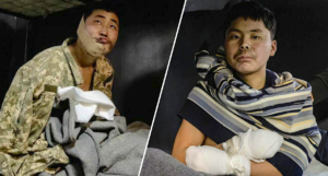 A collage of a person with a bandaged head and a person with a broken armDescription automatically generated